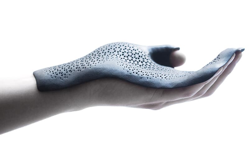 3D printed generative and bespoke orthoses made in collaboration with Mhox