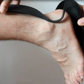 Generative and bespoke orthoses